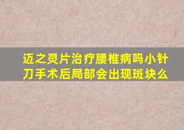 迈之灵片治疗腰椎病吗小针刀手术后局部会出现斑块么